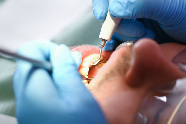 Best Walk-In Dentist Near Me  in Hamlet, NC