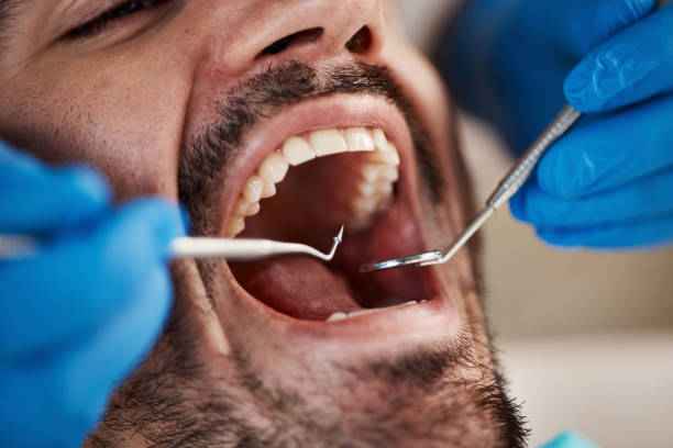 Best Emergency Tooth Extraction  in Hamlet, NC